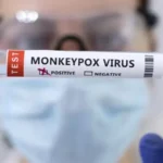 German Doctor Exposes Monkeypox Scam – It’s A COVID-19 Vaccine Side Effect