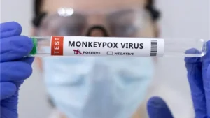 German Doctor Exposes Monkeypox Scam - It’s A COVID-19 Vaccine Side Effect